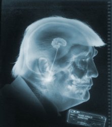 Trump small brain  Treason Idiot Republican Nazi Traitor Meme Template