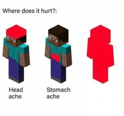 Where does it hurt but in minecraft Meme Template
