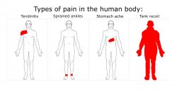 Types of pain in the human body Meme Template