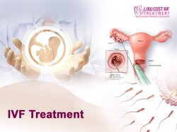 Lowcostivftreatment Meme Template