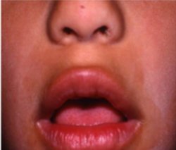 mouth breather Meme Template