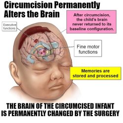 circumcision permanently reprogr (...) Meme Template