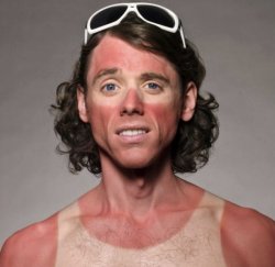 Sun burn guy Meme Template