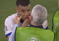 Mbappe broken nose Meme Template