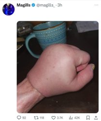 Fist swollen Meme Template