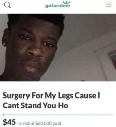 Surgery for my legs Meme Template