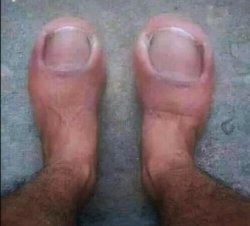 Croc Feet Meme Template
