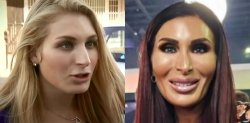 Laura Loomer Before and After plastic surgery Meme Template