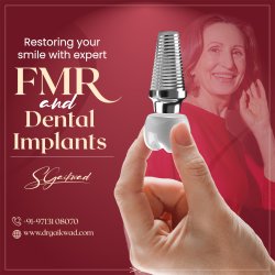 Dr. Shuddhodhan Gaikwad, Leading FMR & Dental Implant Expert in Meme Template