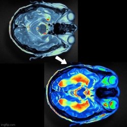 brain before after Meme Template