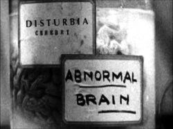 Abnormal brain Abbie Normal Young Frankenstein Igor Eye-gor Meme Template