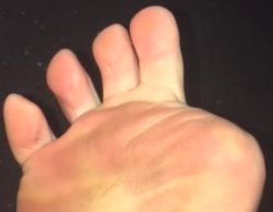 Missing toe Meme Template