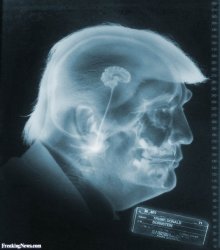 Trump brain moron Republican stupid x-ray JPP Meme Template