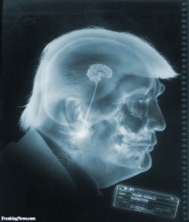 Trump brain moron Republican stupid x-ray JPP Meme Template