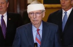 Mitch McConnell Head Bandage Meme Template