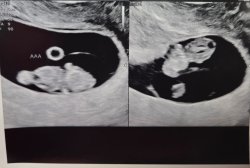 Baby Meme Template