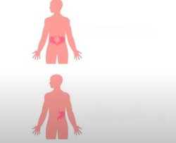 Sold Kidney Meme Template