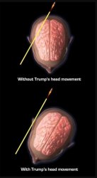 trump head movement Meme Template