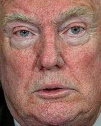 Donald Trump, scabby, blotchy, stupid Meme Template