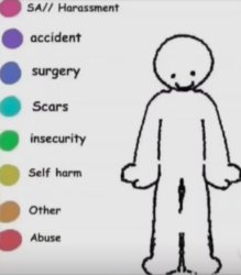 Where is your pain? Meme Template