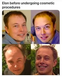 Musk plastic surgery Meme Template