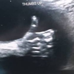 Baby Ultrasound Meme Template