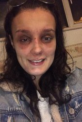 woman with two black eyes MAGA Meme Template
