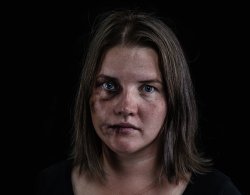Abused wife black eye swollen lip Meme Template