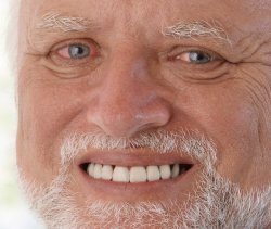 hide_the_pain_harold_sad Meme Template