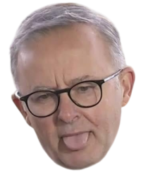 Anthony Albanese Meme Template