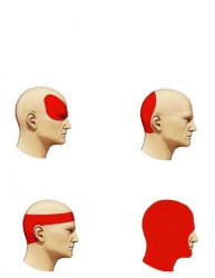 Headache Meme Template