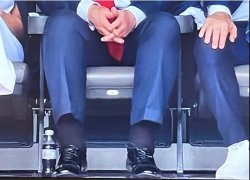 trump swollen ankles cankles heart disease Republican MAGA Meme Template