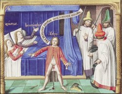 Circumcision Meme Template