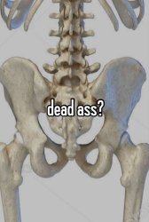 Dead ass? Meme Template