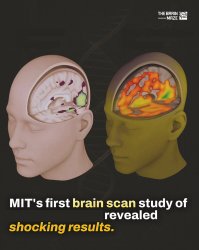 MIT brain scan Meme Template