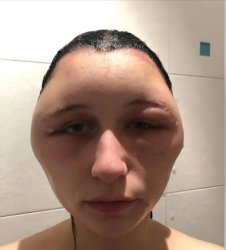 Your face when Meme Template