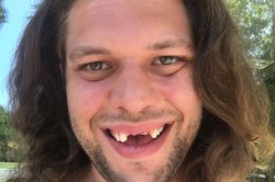 no teeth Meme Template
