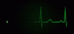 Flatline Meme Template