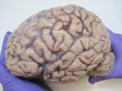 Human Brain Meme Template