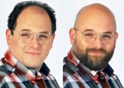 Balding to Bald Meme Template