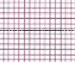 Flatline Meme Template