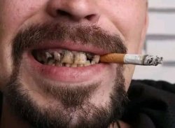 Meth mouth Meme Template