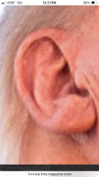 Miracle ear Meme Template