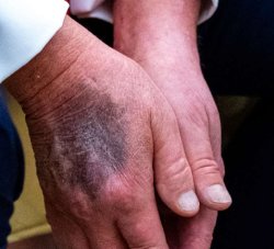 Trump hands Meme Template