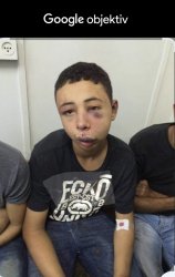 Beaten boy Meme Template