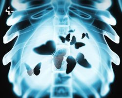 Butterflies in my tummy Meme Template