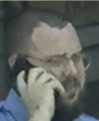 Hairline Bling Meme Template