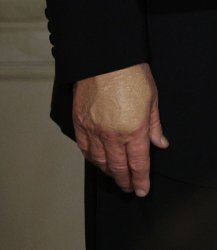 Trumps nasty hand Meme Template