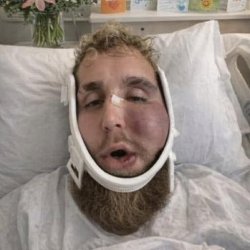 Beaten Paul Meme Template