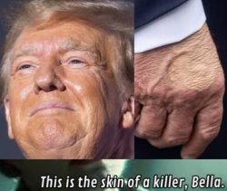 Trump skin issues of a killer Meme Template